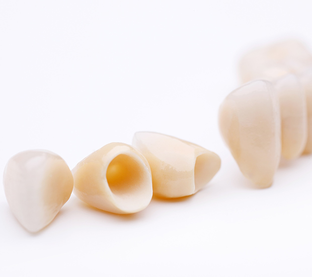 Milwaukee Dental Crowns and Dental Bridges