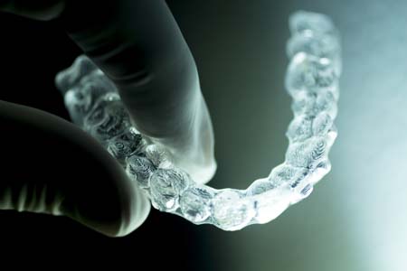 Clear Braces: The Customizable Treatment You Need To Know About