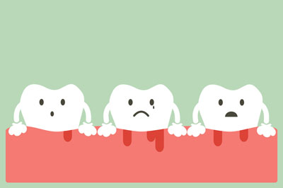 5 Reasons Bleeding Gums Mean It's Time For a visit To the Dentist